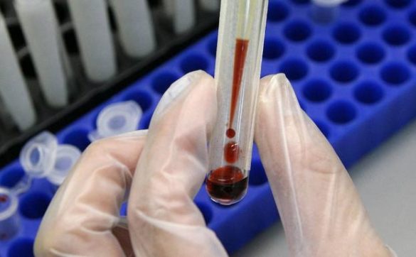 crean-una-tecnologia-para-detectar-cancer-con-una-sola-gota-de-sangre