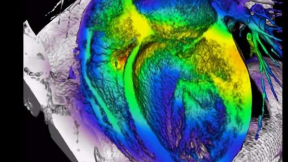 uno-de-cada-diez-pacientes-con-cancer-no-mueren-de-un-tumor-sino-de-problemas-cardiovasculares