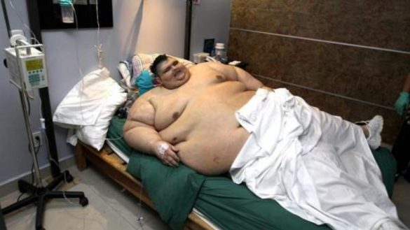 la-lucha-del-hombre-mas-obeso-del-mundo-por-adelgazar-y-volver-a-caminar