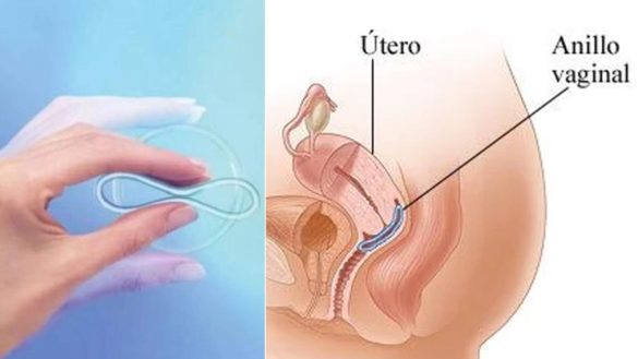 sanidad-financia-el-anillo-vaginal-anticonceptivo-como-se-pone-eficacia-y-efectos-secundarios