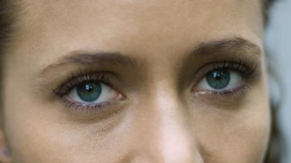 tratamientos-esteticos-con-hilos-tensores.-para-que-sirven-y-cuando-estan-indicados