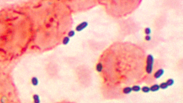 identifican-el-8216talon-de-aquiles8217-de-la-superbacteria-resistente-a-los-medicamentos