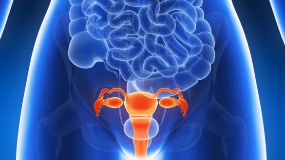 endometriosis-que-es-diagnostico-y-tratamiento