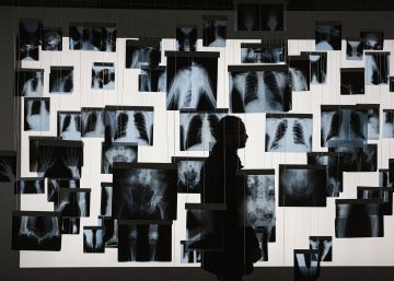 radiografia-de-la-sanidad-catalana