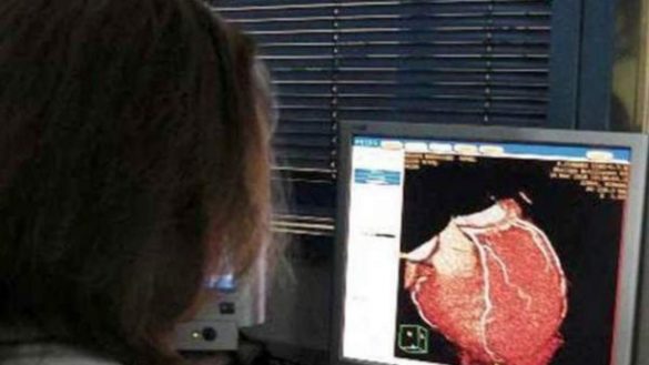 la-conexion-del-corazon-y-los-rinones-la-enfermedad-cardiaca-implica-mayor-riesgo-de-insuficiencia-renal