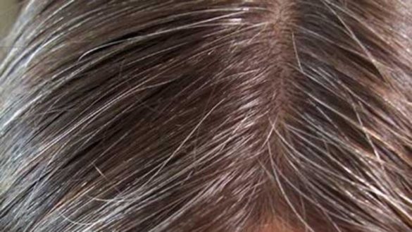 la-ciencia-confirma-que-el-estres-produce-canas