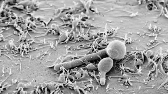 un-nuevo-estudio-arroja-luz-sobre-como-se-propaga-8216candida-auris8217-una-amenaza-creciente-en-los-hospitales