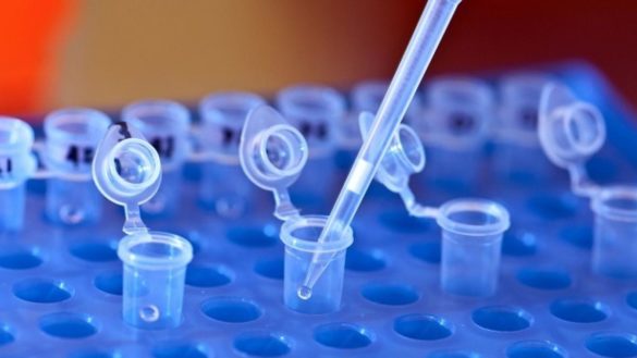 identifican-102-genes-asociados-con-el-autismo