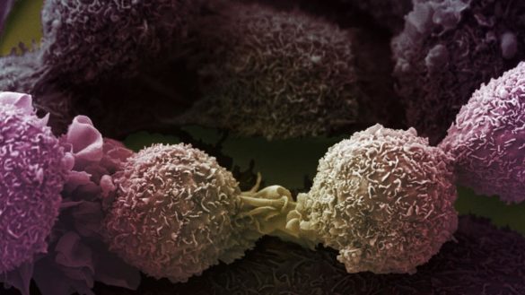 el-mayor-estudio-sobre-el-genoma-del-cancer-permitira-detectarlo-antes-y-desarrollar-tratamientos-personalizados