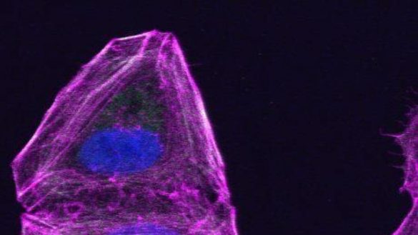 descubren-material-genetico-que-impide-que-las-celulas-cancerosas-formen-metastasis