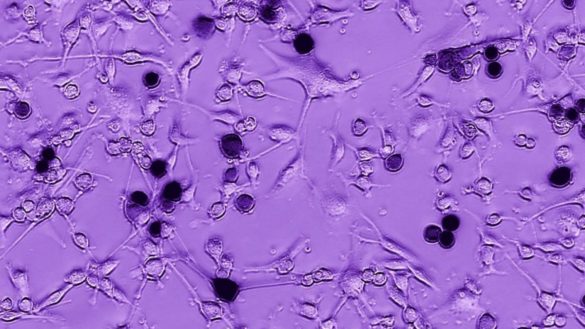 descubren-en-el-ebola-un-aliado-en-la-lucha-contra-los-tumores-cerebrales