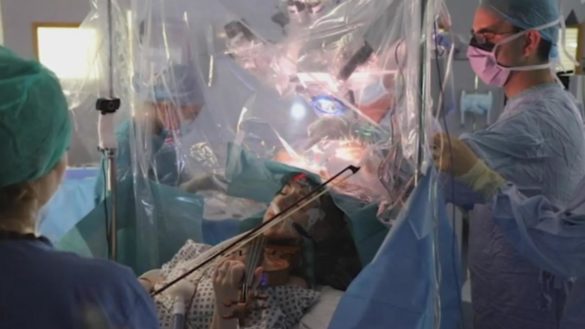 una-mujer-toca-el-violin-mientras-esta-siendo-operada-de-un-tumor-cerebral