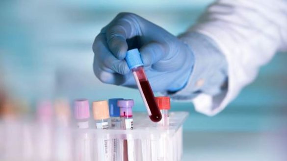 crean-un-metodo-que-detecta-el-alzheimer-con-un-analisis-de-sangre