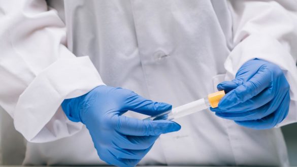 sanidad-hara-de-forma-inmediata-el-test-de-coronavirus-a-las-personas-con-sintomas-en-su-casa