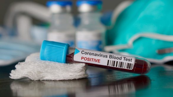 asi-son-los-ensayos-en-marcha-en-espana-para-frenar-al-coronavirus