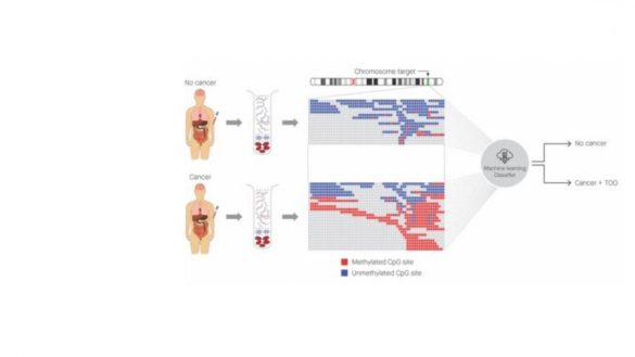 el-primer-analisis-de-sangre-que-es-capaz-de-detectar-50-tipos-de-cancer