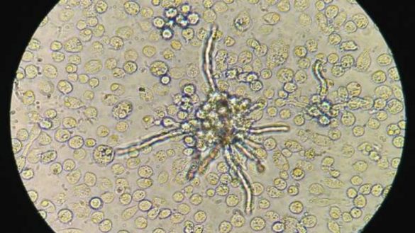 como-el-sistema-inmunitario-trata-las-infecciones-virales
