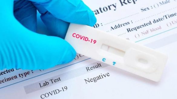 cuantos-test-hay-para-diagnosticar-el-coronavirus-y-en-que-se-diferencian