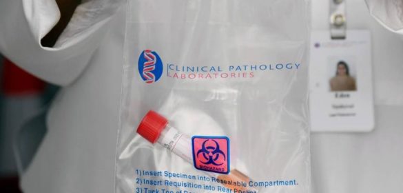 un-ambicioso-programa-de-investigacion-busca-la-cura-contra-el-coronavirus