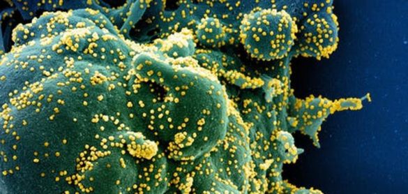 los-tres-tests-del-coronavirus-que-juntos-nos-ayudaran-a-controlar-la-pandemia