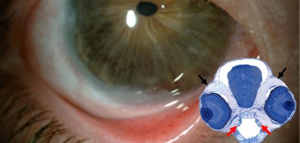 una-investigacion-con-peces-cebra-descubre-la-alteracion-de-un-gen-que-provoca-glaucoma-congenito