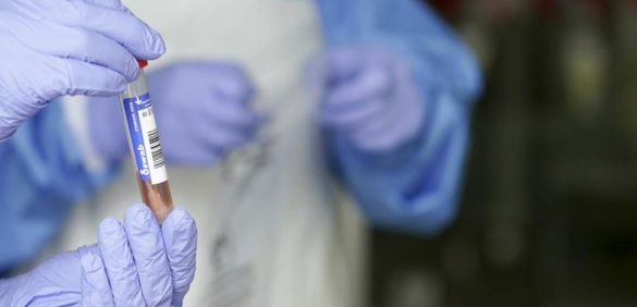 sanidad-ignora-la-oferta-de-un-consorcio-de-laboratorios-para-hacer-10.000-pruebas-al-dia