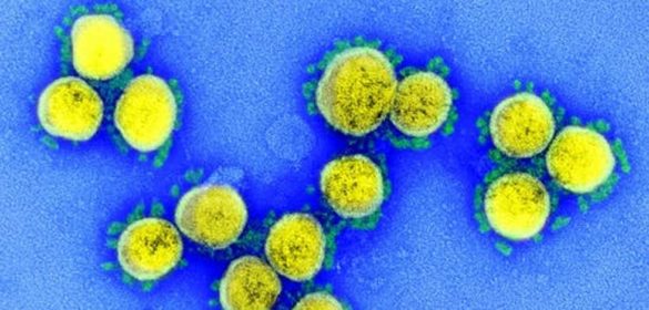 el-virus-de-la-covid-19-ni-se-creo-ni-se-escapo-de-un-laboratorio