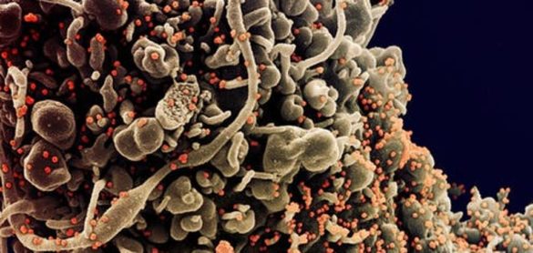 esto-es-lo-que-los-virologos-saben-hasta-hoy-sobre-el-coronavirus-sars-cov-2