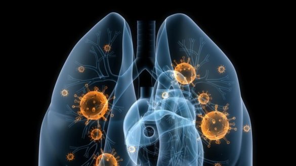 pharmamar-sube-en-bolsa-tras-acordar-la-venta-de-un-nuevo-farmaco-para-el-cancer-de-pulmon-a-varios-paises