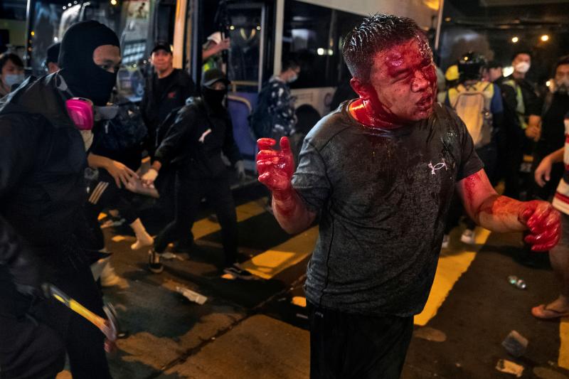 Violencia policial