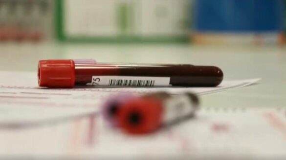 plasma-de-hiperinmunes-como-alternativa-contra-el-coronavirus-a-la-espera-de-la-vacuna