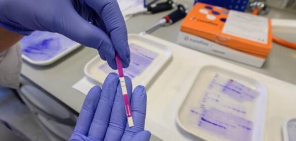el-test-de-anticuerpos-del-csic,-con-fiabilidad-casi-100%,-llega-al-mercado