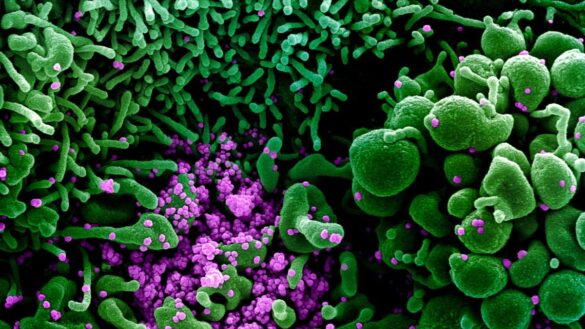 hallan-el-factor-que-hace-mas-contagiosa-a-la-cepa-britanica-de-coronavirus:-una-mutacion-de-la-proteina-‘spike’