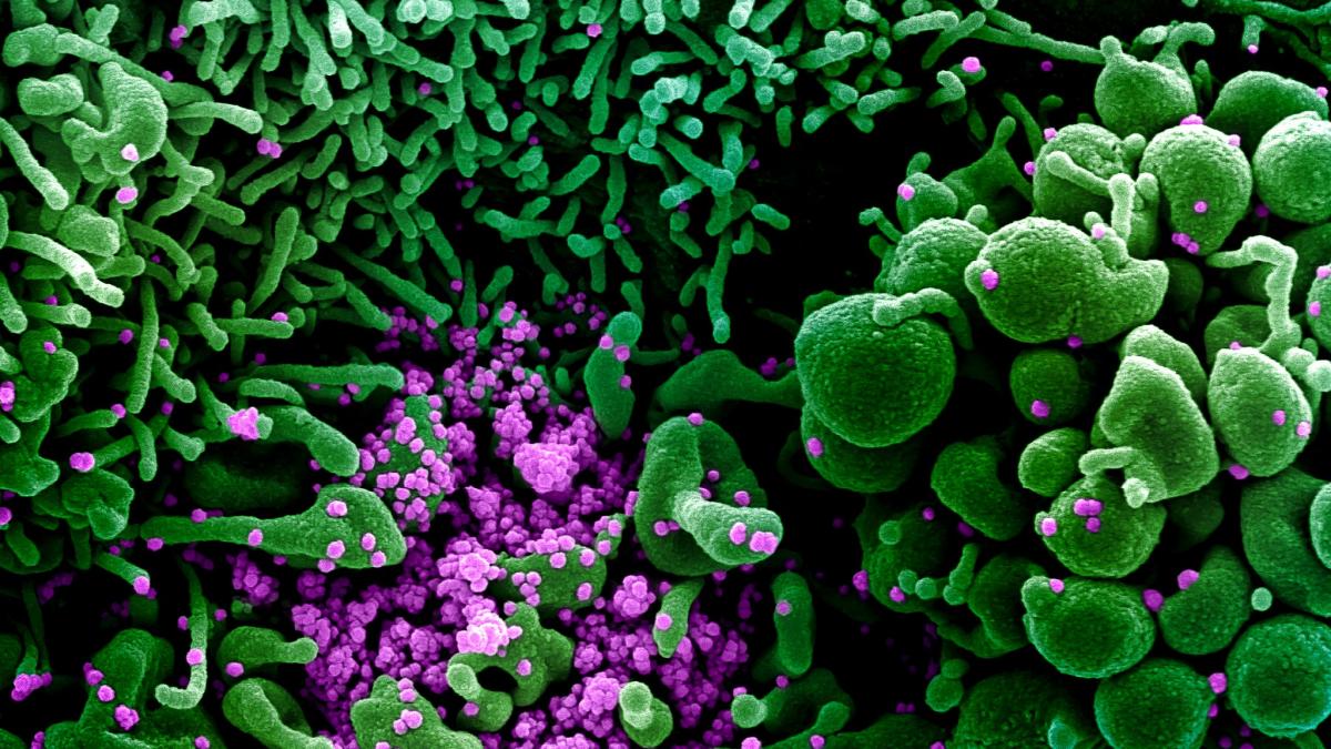 Hallan el factor que hace más contagiosa a la cepa británica de coronavirus: una mutación de la proteína ‘spike’