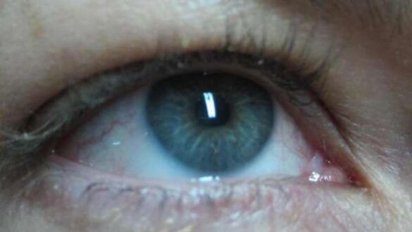 ¿como-aliviar-el-picor-de-ojos-por-la-noche?