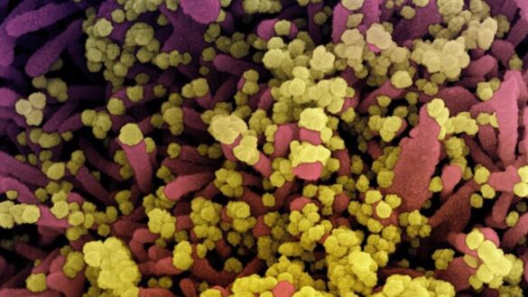 asi-es-la-capa-de-azucar-que-ayuda-al-coronavirus-a-esconderse-de-nuestro-sistema-inmunitario