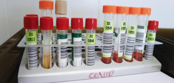 un-antiviral-espanol-reduce-el-99%-la-carga-viral-de-la-covid-19