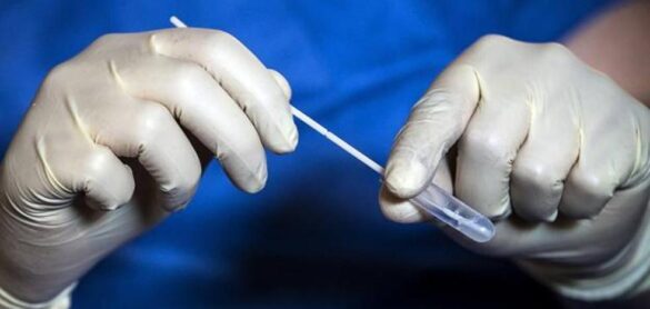 galicia-ya-realiza-test-anales-para-diagnosticar-el-coronavirus