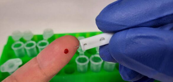 el-csic-desarrolla-un-test-de-anticuerpos-con-el-99%-de-fiabilidad