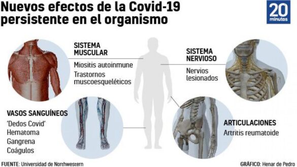 brotes-de-artritis,-gangrena-o-dolor-en-el-hombro:-identifican-sintomas-raros-de-la-covid-19-persistente