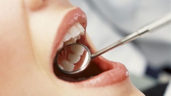 los-odontologos-alertan:-usar-mascarilla-ha-modificado-la-higiene-bucodental