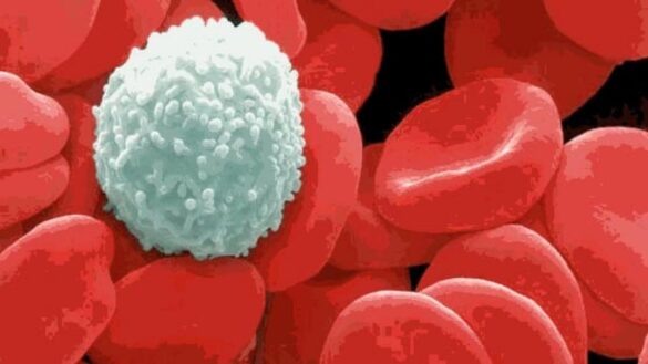 crean-‘super-soldados’-de-globulos-blancos-contra-el-cancer