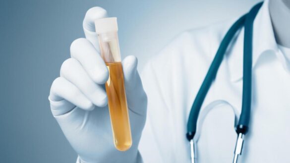 sintomas-de-una-infeccion-de-orina:-como-saber-cuando-acudir-a-urgencias