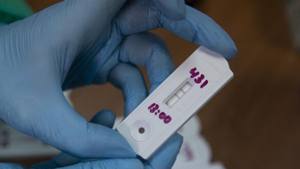 los-test-rapidos-de-autodiagnostico-se-abren-camino-en-europa:-«deberian-estar-disponibles-como-un-test-de-embarazo»
