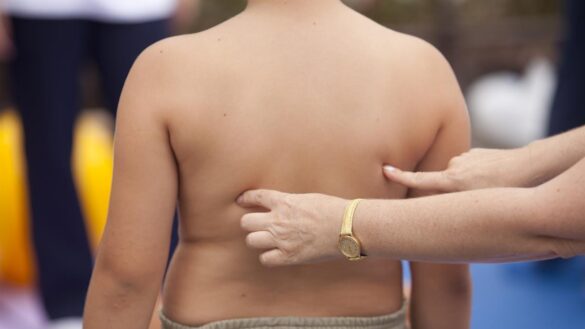 dia-mundial-de-la-obesidad-2021:-que-factores-favorecen-la-obesidad-infantil