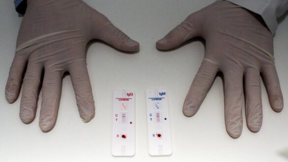 lidl:-asi-es-el-test-de-coronavirus-‘low-cost’-que-ha-comenzado-a-vender