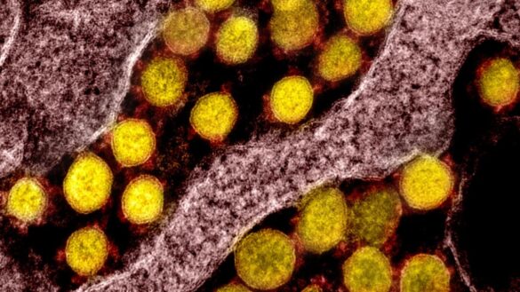 ¿como-aumenta-la-infectividad-del-sars-cov-2-conforme-aparecen-variantes?