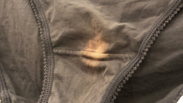 por-que-pueden-aparecer-manchas-claras-en-la-ropa-interior-femenina-de-color-oscuro