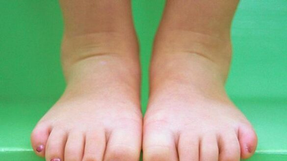 lo-que-debes-tener-en-cuenta-cuando-acudes-a-un-centro-de-estetica-para-embellecer-tus-pies