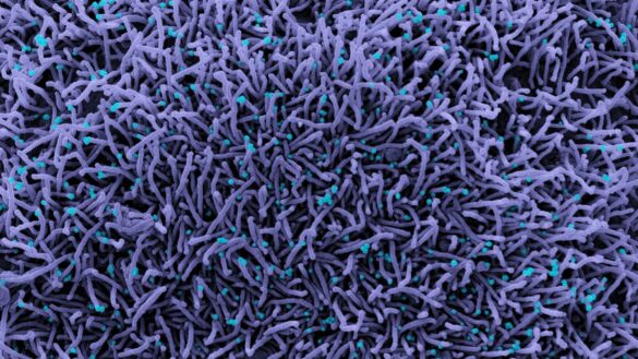 un-estudio-evidencia-que-la-covid-19-causa-una-respuesta-celular-«inesperada»-en-los-pulmones